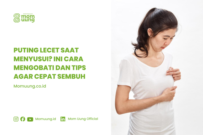 Tips Mengobati Puting Lecet Saat Menyusui