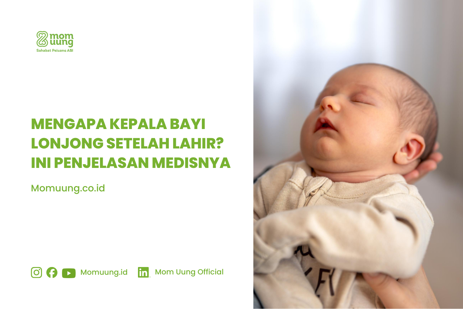 Kepala Bayi Lonjong Setelah Lahir? Kenali Penyebabnya dan Teknik Napas yang Bisa Membantu