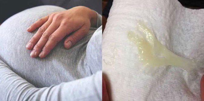 Keluar Lendir Tanpa Darah Apakah Tanda Mau Melahirkan? Keluar Lendir Tanpa Darah Apakah Tanda Mau Melahirkan?